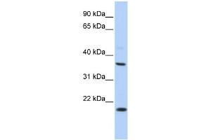 Image no. 1 for anti-Potassium Large Conductance Calcium-Activated Channel, Subfamily M beta Member 3 (KCNMB3) (Middle Region) antibody (ABIN2776296)