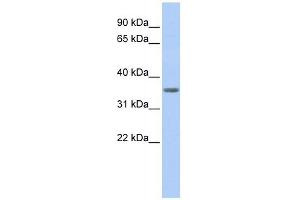Image no. 1 for anti-Protein Phosphatase 1, Regulatory (Inhibitor) Subunit 11 (PPP1R11) antibody (ABIN632318)
