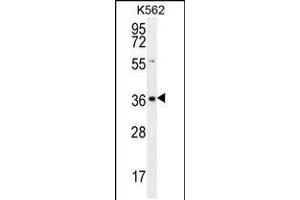 anti-Solute Carrier Family 25 (Mitochondrial Carrier, Adenine Nucleotide Translocator), Member 31 (SLC25A31) (AA 139-167) antibody