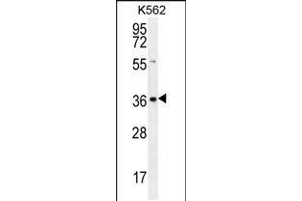SLC25A31 Antikörper  (AA 139-167)