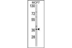 Image no. 1 for anti-Aspartoacylase (ASPA) (AA 89-118), (N-Term) antibody (ABIN452768)