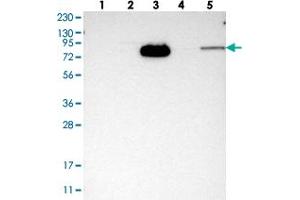 Image no. 2 for anti-Holliday Junction Recognition Protein (HJURP) antibody (ABIN5579959)