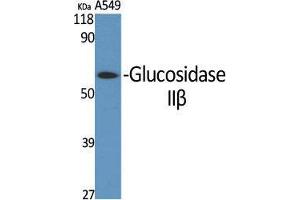 Image no. 2 for anti-Glucosidase, beta (Bile Acid) 2 (GBA2) (Internal Region) antibody (ABIN3184804)