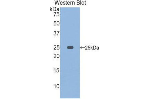 OSTF1 antibody  (AA 10-215)