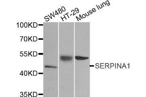 Image no. 1 for anti-serpin Peptidase Inhibitor, Clade A (Alpha-1 Antiproteinase, Antitrypsin), Member 1 (SERPINA1) antibody (ABIN3021276)