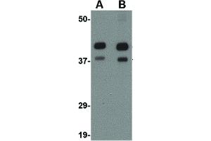 Image no. 2 for anti-Aryl Hydrocarbon Receptor Interacting Protein-Like 1 (AIPL1) (Internal Region) antibody (ABIN6656626)