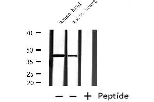 Image no. 4 for anti-Glutamine Synthetase (GLN1) antibody (ABIN6261999)