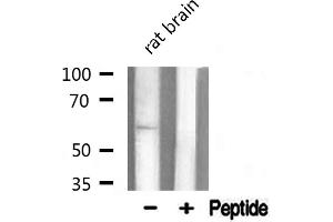 Image no. 1 for anti-TNF Receptor-Associated Factor 6 (TRAF6) (Internal Region) antibody (ABIN6265707)