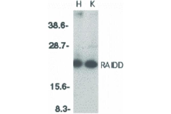 CRADD antibody  (Internal Region)