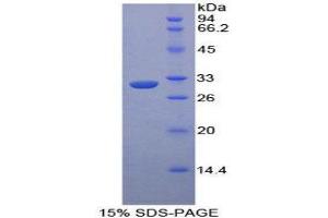 Image no. 1 for Mitogen-Activated Protein Kinase Kinase Kinase 5 (MAP3K5) (AA 693-933) protein (His tag) (ABIN1879239)