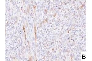Image no. 4 for anti-L1 Cell Adhesion Molecule (L1CAM) (AA 1-1120) antibody (ABIN1995799)
