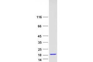 Image no. 1 for NHP2 Non-Histone Chromosome Protein 2-Like 1 (NHP2L1) (Transcript Variant 1) protein (Myc-DYKDDDDK Tag) (ABIN2727262)