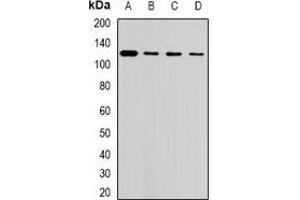 Image no. 2 for anti-Ubiquitin Specific Peptidase 26 (USP26) antibody (ABIN3197838)