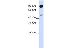 Image no. 1 for anti-Adducin 2 (Beta) (ADD2) (Middle Region) antibody (ABIN2784900)