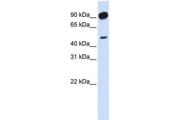 anti-Adducin 2 (Beta) (ADD2) (Middle Region) antibody