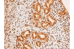 Image no. 9 for anti-Jun Proto-Oncogene (JUN) (pThr91) antibody (ABIN6256604)