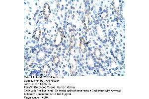 Image no. 1 for anti-General Transcription Factor II I Repeat Domain-Containing 1 (GTF2IRD1) (C-Term) antibody (ABIN2781010)