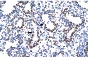 Image no. 1 for anti-Ha-Ry/enhancer-of-Split Related with YRPW Motif 1 (HEY1) (C-Term) antibody (ABIN2779686)