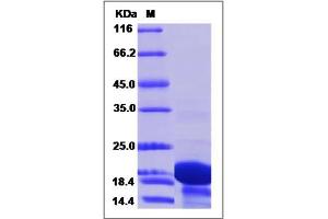 Image no. 1 for Tubulin Polymerization Promoting Protein 2 (TPPP2) (AA 1-170) protein (His tag) (ABIN2006408)