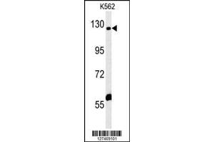Image no. 1 for anti-IQ Motif and Sec7 Domain 3 (IQSEC3) (AA 24-52), (N-Term) antibody (ABIN652154)