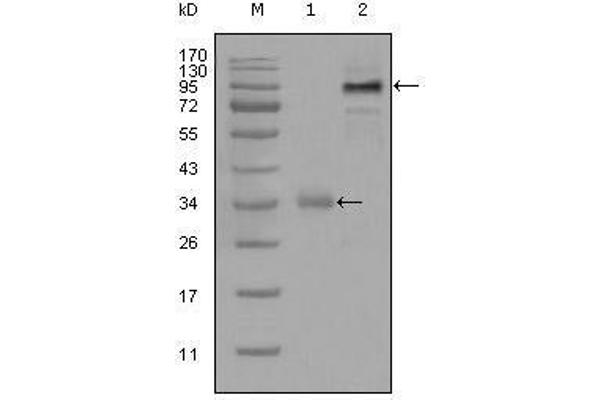 anti-Ets Variant 1 (ETV1) (AA 1-191) antibody