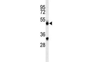 Image no. 1 for anti-Complement Factor P (CFP) (AA 197-223) antibody (ABIN3030563)