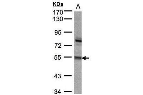 anti-Zinc Finger Protein 165 (ZNF165) (Center) antibody