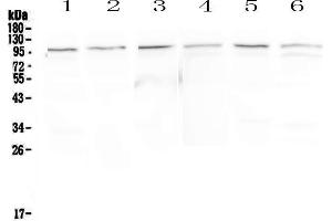Image no. 2 for anti-Major Vault Protein (MVP) (AA 2-259) antibody (ABIN5692897)