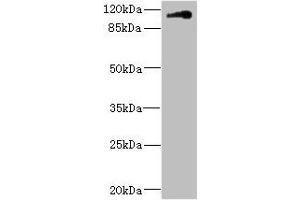 Western blot All lanes: CNTN4 antibody IgG at 1.