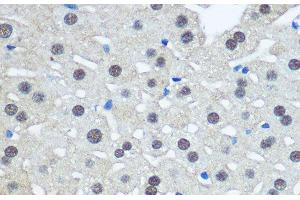 Immunohistochemistry of paraffin-embedded Rat liver using UBA1 Polyclonal Antibody at dilution of 1:100 (40x lens).