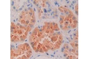 MAN2B1 antibody  (AA 883-1011)