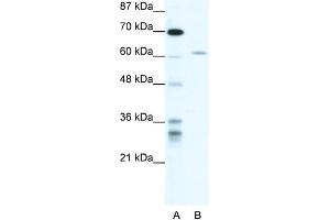 Image no. 2 for anti-IKAROS Family Zinc Finger 4 (Eos) (IKZF4) (N-Term) antibody (ABIN2777833)