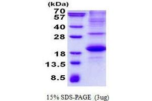Signaling Lymphocytic Activation Molecule Family Member 1 (SLAMF1) protein