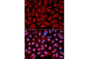 Image no. 1 for anti-Mitogen-Activated Protein Kinase Kinase 7 (MAP2K7) antibody (ABIN3023157)