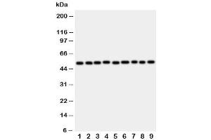 Image no. 2 for anti-E2F Transcription Factor 2 (E2F2) (C-Term) antibody (ABIN3030789)