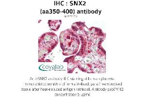 Image no. 1 for anti-Sorting Nexin 2 (SNX2) (AA 350-400) antibody (ABIN1739490)