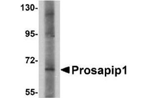 Western blot analysis of Prosapip1 in SK-N-SH cell lysate with AP30693PU-N Prosapip1 antibody at 1 µg/ml.