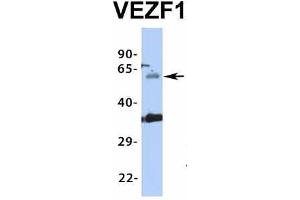Image no. 6 for anti-Vascular Endothelial Zinc Finger 1 (VEZF1) (Middle Region) antibody (ABIN2776482)