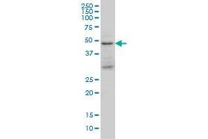 Image no. 3 for anti-Tumor Susceptibility Gene 101 (TSG101) (AA 201-280) antibody (ABIN563269)