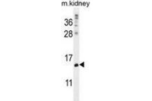 MORN5 Antikörper  (C-Term)