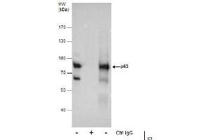Image no. 1 for anti-T-Complex 1 (TCP1) (Internal Region) antibody (ABIN2855394)
