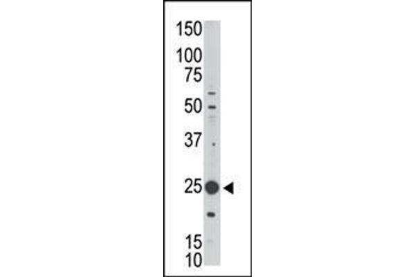 anti-Melanoma Antigen Family H, 1 (MAGEH1) (AA 186-218), (C-Term) antibody