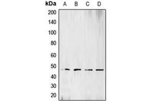 Image no. 3 for anti-Branched Chain Ketoacid Dehydrogenase Kinase (BCKDK) (N-Term) antibody (ABIN2707359)