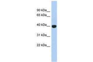 Image no. 1 for anti-KIAA1191 (KIAA1191) (AA 179-228) antibody (ABIN6744040)