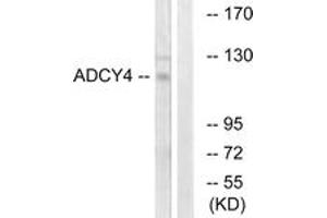 Image no. 1 for anti-Adenylate Cyclase 4 (ADCY4) (AA 195-244) antibody (ABIN1534253)