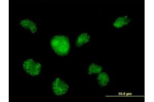 Image no. 2 for anti-Calmodulin Like Protein 3 (CALML3) (AA 1-149) antibody (ABIN513958)