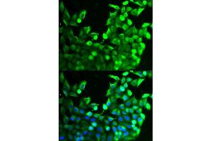 Image no. 3 for anti-Fibroblast Growth Factor Receptor 2 (FGFR2) antibody (ABIN3022855)