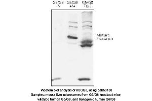 Image no. 1 for anti-ATP-Binding Cassette, Sub-Family G (WHITE), Member 8 (ABCG8) (N-Term) antibody (ABIN363412)