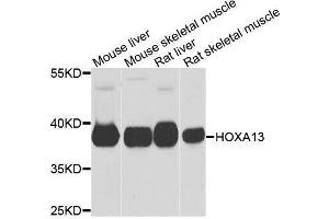 Image no. 1 for anti-Homeobox A13 (HOXA13) antibody (ABIN6141935)