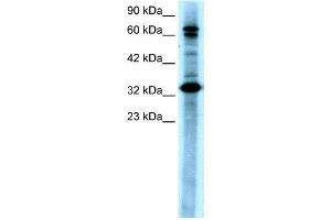 Image no. 4 for anti-TGF-beta Activated Kinase 1/MAP3K7 Binding Protein 2 (TAB2) (N-Term) antibody (ABIN2779619)